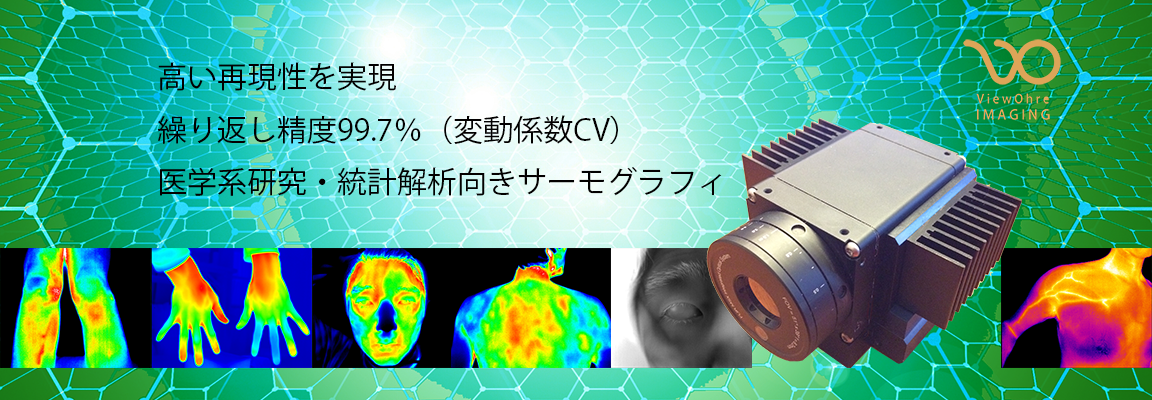 サーモグラフィ